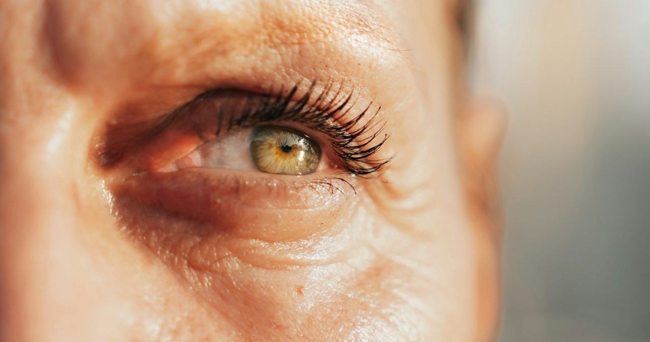 Kurze łapki wokół oczu pojawiają się szybko, bo skóra w tym miejscu jest cienka /amein shareef77 /unsplash.com