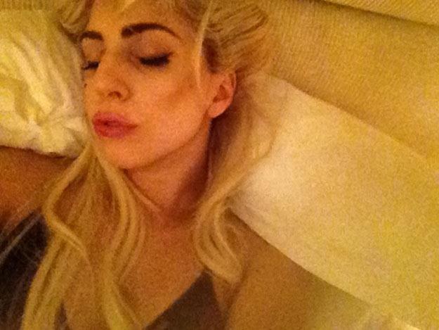 Lady Gaga z napuchniętymi ustami /