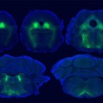 Łagodzenie bólu bez leków? Naukowcy ogłaszają przełom w badaniach efektu placebo 