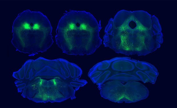 Łagodzenie bólu bez leków? Naukowcy ogłaszają przełom w badaniach efektu placebo 