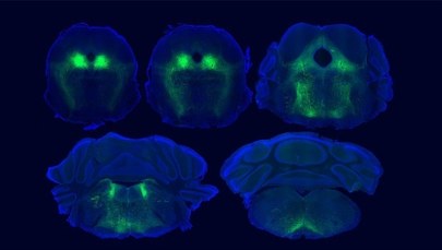 Łagodzenie bólu bez leków? Naukowcy ogłaszają przełom w badaniach efektu placebo 