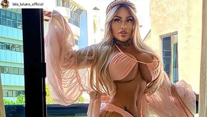 Laluna Unique nie kryje swojej miłości do poprawiania urody w gabinetach medycyny estetycznej /@ lala_laluna_official /Instagram