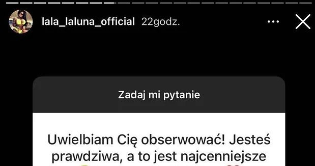 Laluna Unique Pokazała Jak Wygląda Po Operacjach Bardzo Się Zmieniła Pomponikpl 7420