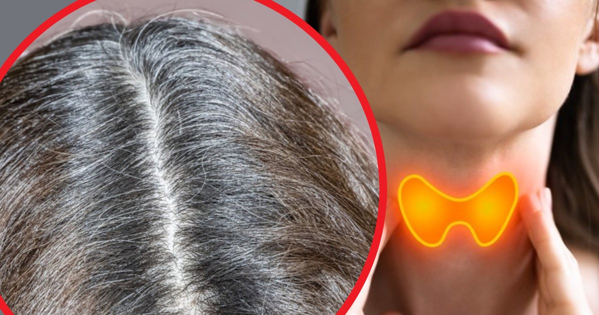 Łamliwe, puszące się i niesforne włosów mogą być efektem niedoborów witamin lub chorób tarczycy /123RF/PICSEL