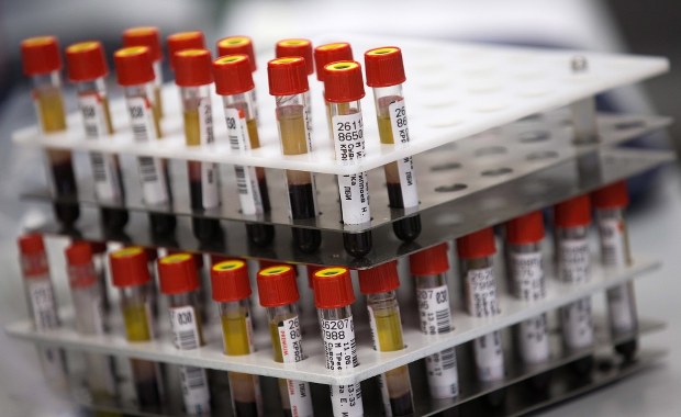 Leczenie COVID-19 osoczem: Pobrano krew od pierwszych ozdrowieńców