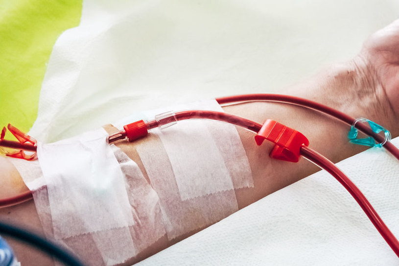 Leczenie czerwienicy polega na regularnym upuszczaniu krwi /123RF/PICSEL