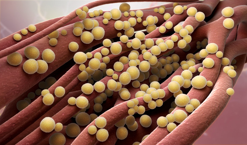Leczenie gronkowca złocistego opiera się na wdrożeniu odpowiedniej antybiotykoterapii /123RF/PICSEL