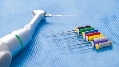 Leczenie kanałowe – kiedy jest konieczne?