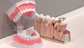 Leczenie zębów już nie boli – najnowsze rodzaje znieczulenia