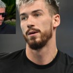 Ledwo Lewandowski zmienił kolor włosów i się zaczęło. Fornal mówi to wprost