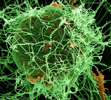 Lek na ebolę 100-procentowo skuteczny u małp