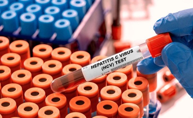 Lekarze apelują: Ten test każdy powinien wykonać co najmniej raz w życiu