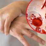 Lekarze nie mogą znaleźć przyczyny, robią bezsensowne operacje, a chory wyje z bólu