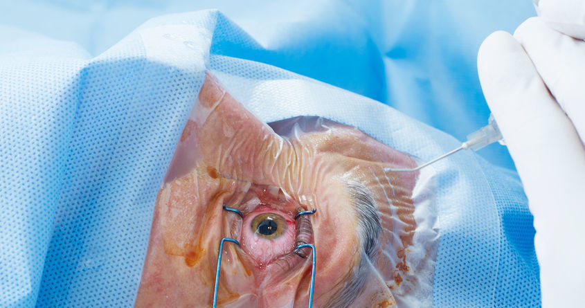 Lekarze przeprowadzający operację na oku /123RF/PICSEL