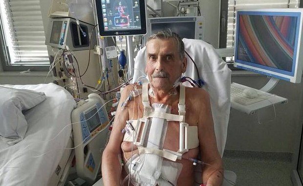 Lekarze z Centrum Chorób Serca w Zabrzu wszczepili pacjentowi sztuczne serce