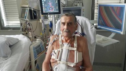 Lekarze z Centrum Chorób Serca w Zabrzu wszczepili pacjentowi sztuczne serce