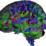Lepiej zorganizowany mózg wie więcej