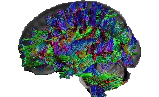 Lepiej zorganizowany mózg wie więcej
