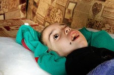Liban: Rodzina Arkana na krawędzi. Chłopiec cierpi. Potrzebuje pomocy