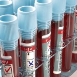Liczba przypadków HIV bije rekordy. Czy Polacy są świadomi zagrożenia?