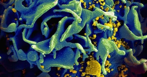 Limfocyt atakowany przez wirusa HIV /materiały prasowe