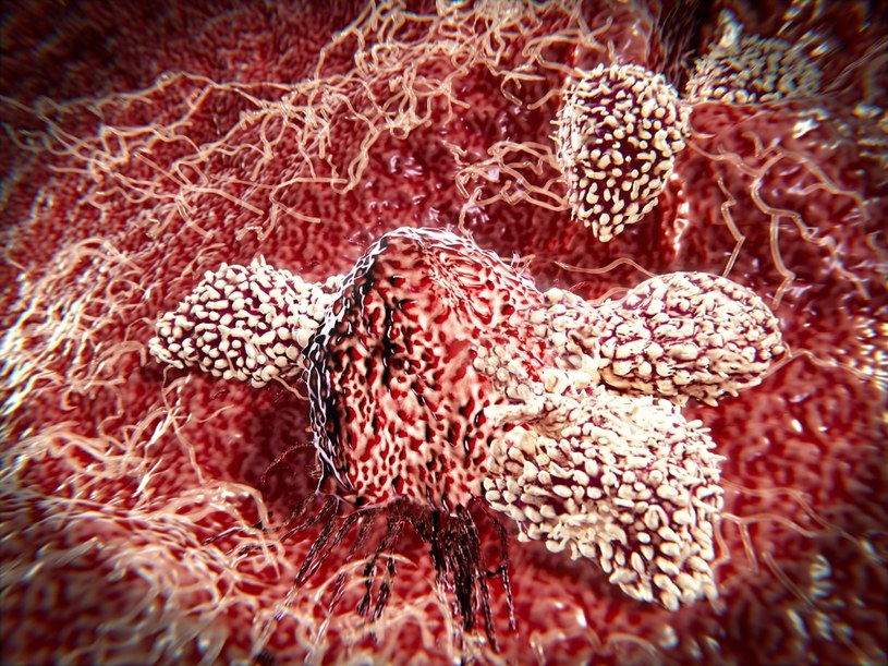Limfocyty T atakujące nowotwór /123RF/PICSEL
