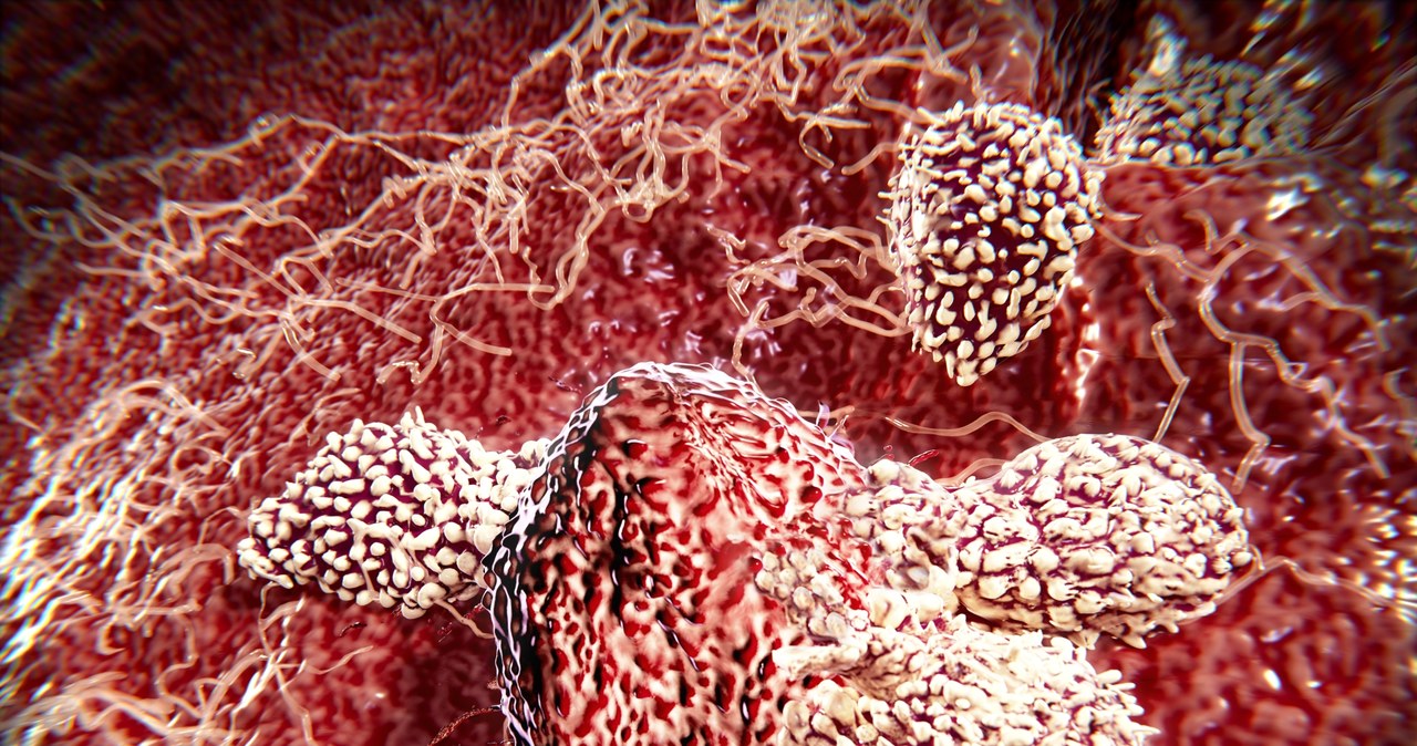 Limfocyty T atakujące nowotwór /123RF/PICSEL