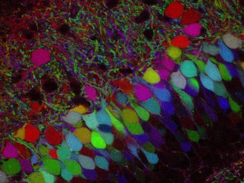 Ludzie neurony można hodować w ciałach szczurów (tu na kolorowo) /AFP