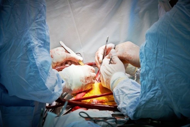 Ludzie wciąż boją się ksenotransplantacji - nie bez powodu /123RF/PICSEL