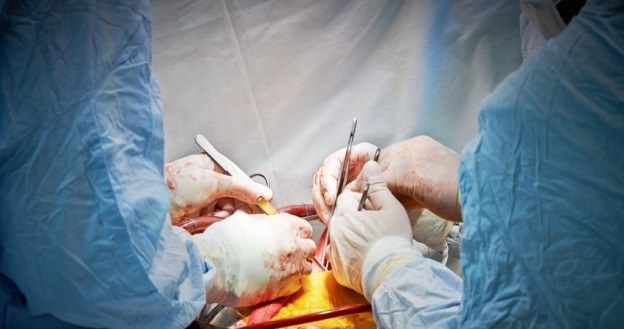 Ludzie wciąż boją się ksenotransplantacji - nie bez powodu /123RF/PICSEL