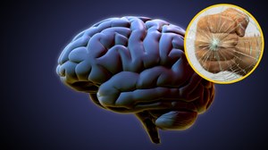 Ludzki mózg może zapaść się pod własnym ciężarem! Czyli nowe odkrycie naukowców