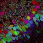 Ludzkie komórki mózgu rosną w ciałach szczurów