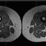 Ludzkie udo jak marmurkowy stek. Przetworzona żywność zmienia nasze ciała