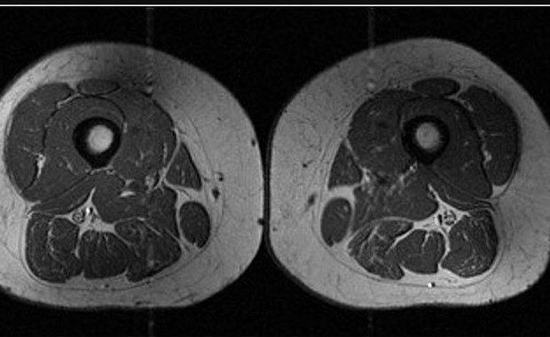 Ludzkie udo jak marmurkowy stek. Przetworzona żywność zmienia nasze ciała