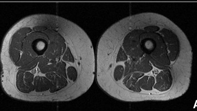 Ludzkie udo jak marmurkowy stek. Przetworzona żywność zmienia nasze ciała