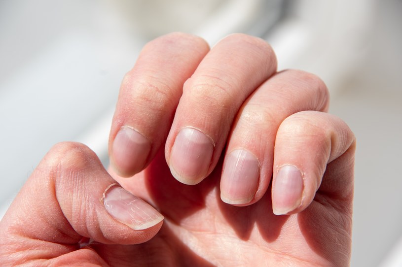 Lunule, czyli obłączki, na paznokciach mogą wiele powiedzieć o twoim zdrowiu /123RF/PICSEL