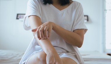 Łuszczyca to choroba autoimmunologiczna. Choć nieuleczalna, można mieć ją pod kontrolą