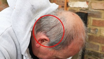 Łysi odetchną z ulgą. Jastrząb-łowca w końcu schwytany