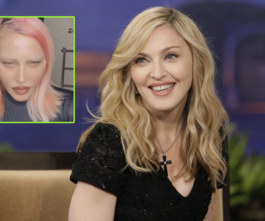Madonna: co stało się z jej twarzą? Niepokojące zdjęcia królowej popu