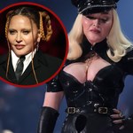 Madonna przesadziła z operacjami plastycznymi. Co się stało z jej twarzą?