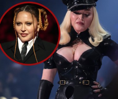 Madonna przesadziła z operacjami plastycznymi. Co się stało z jej twarzą?