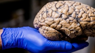 Mądrzejsi już nie będziemy, nie bądźmy głupsi