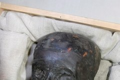 Malaria i choroby kości zabiły Tutanchamona?