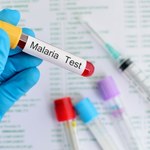 Malaria - objawy i postępowanie