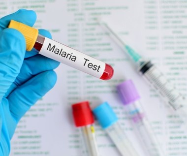 Malaria - objawy i postępowanie