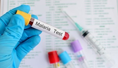 Malaria - objawy i postępowanie