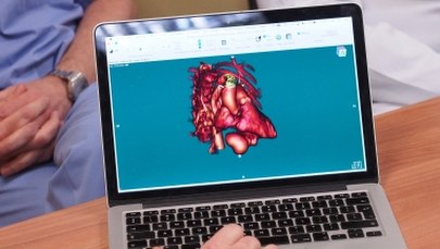 Małe jest piękne, ale... drogie. W Krakowie wszczepiono najmniejsze na świecie rozruszniki serca