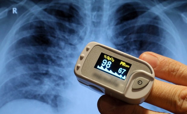 Malinowski: Państwo powinno dofinansować zakup pulsoksymetrów