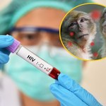 Małpia Ospa uderza w chorujących na HIV. Wszystko przez brak odporności