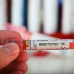 Małpia ospa w Niemczech. Liczba przypadków wzrosła do 33